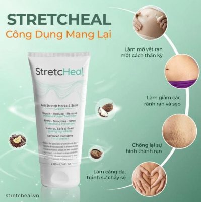 Kem rạn da StretcHeal 180ml Mỹ an toàn cho mẹ bầu