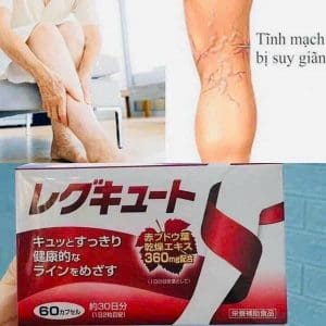 Viên trị suy giãn tĩnh mạch Unitech 60 viên Nhật Bản