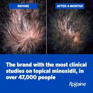 Bọt mọc tóc cho nam Men's Rogaine Minoxidil 5% Set Foam 60g x 3 lọ của Mỹ Bọt mọc tóc dành cho nam Men's Rogaine Minoxidil 5% Set Foam 60g x3 lọ của Mỹ