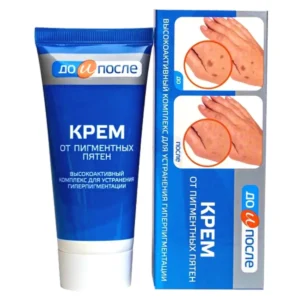 Kem Da Tay Kpem Koppektop Nga