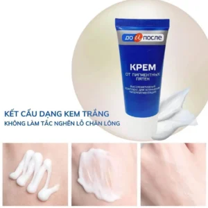Kem Dưỡng Da Tay Chống Nhăn Giảm Gân Xanh Kpem Nga 100ml